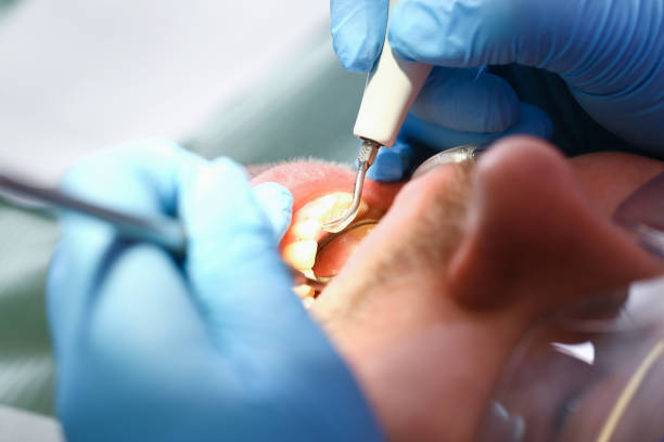Best Emergency Gum Treatment in Chesapeake, WV