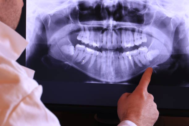 Best Emergency TMJ Treatment in Chesapeake, WV