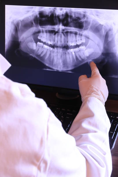 Best Emergency Tooth Extraction in Chesapeake, WV