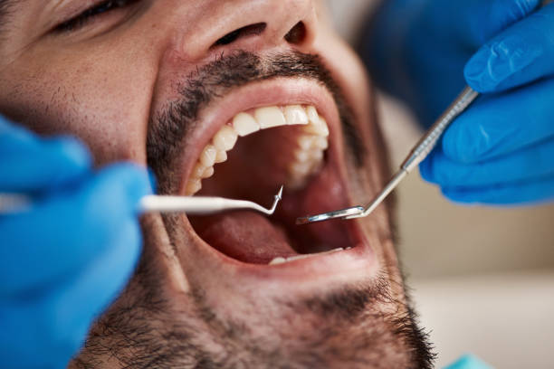 Best Emergency Treatment for Dental Infections or Abscesses in Chesapeake, WV